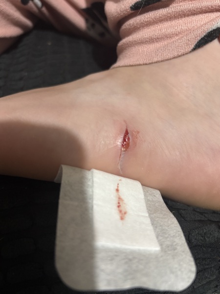 Tw- Gore (kind of)