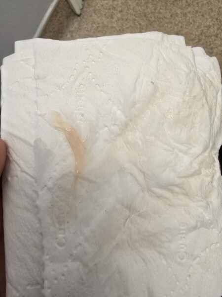 9 weeks and pink discharge?