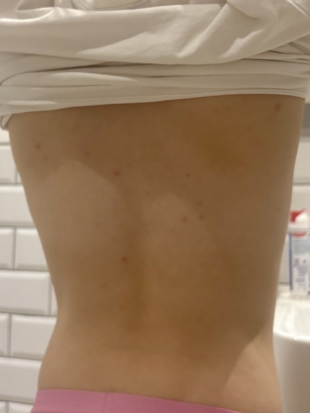 What are these spots on dd8?