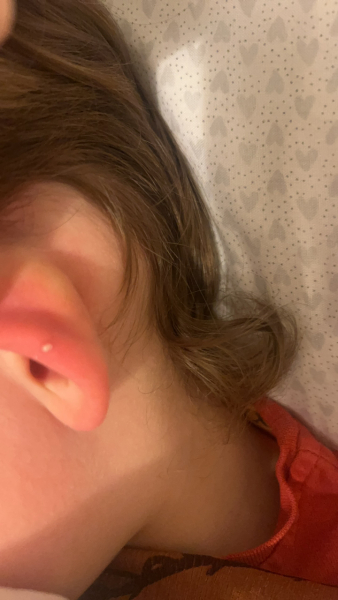 White spot on ear?