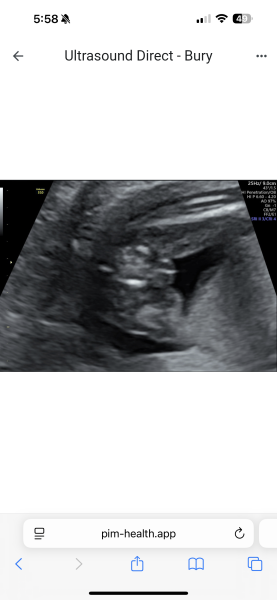 Boy or girl?