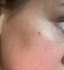 Are there any dermatologists here that can help please?