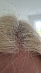 NMN reversing grey hair
