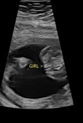 Gender scan opinion