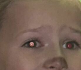AIBU? Daughter has white eye in flash photo!