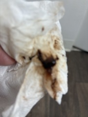 Warning pic attached!! Implantation bleeding?