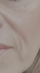 What to about these jowls?