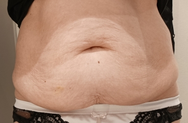 Own your apron belly ladies!
