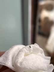 Do these look like fleas?
