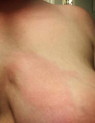 I’m cultivating a third boob, do you want to see it?