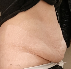Own your apron belly ladies!