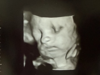 Due January 2026 - Thread 3