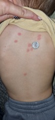 Spots