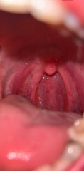 Sobbing with the pain, sore throat?
