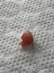 What is this please (inc pic)