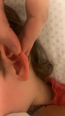 White spot on ear?
