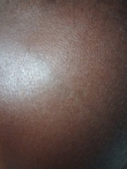 My baby dented her forehead on the skirting board. I am so upset. Pic included.