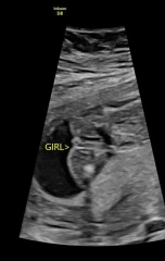 Gender scan opinion