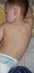 Spots