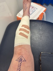 Thread #6, living with incurable cancer, taking ALL the drugs, and remembering our fallen comrades