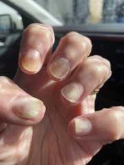 11 year old has done her own nails with UV lamp