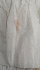 Is this implantation bleeding?