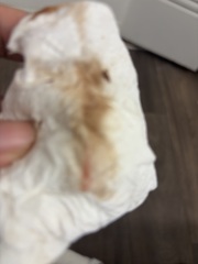 Warning pic attached!! Implantation bleeding?