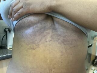 What could this be on my skin on my private parts ?!