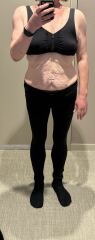 Own your apron belly ladies!