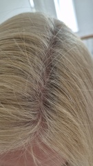 NMN reversing grey hair