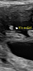 Girl or boy?