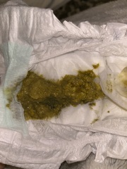 Normal amount of mucus in poo? IMAGES ATTACHED!