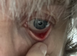 What is this? Eye (pics attached )