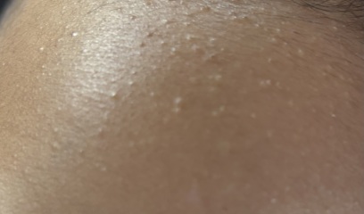 Baby skin rash/spots 3 months