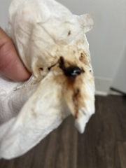 Warning pic attached!! Implantation bleeding?