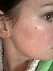 Are there any dermatologists here that can help please?