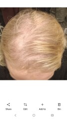 Possible B12 and Iron issues - GP not interested at all, what should I do?
