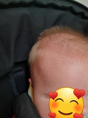 Uncombable hair syndrome or overthinking it??