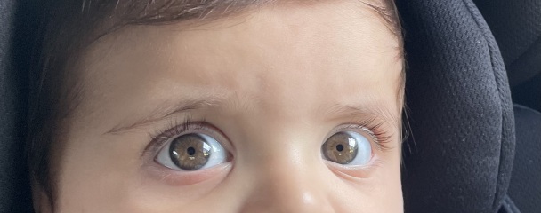 Babies eye colour 7 month old