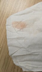 Is this implantation bleeding?