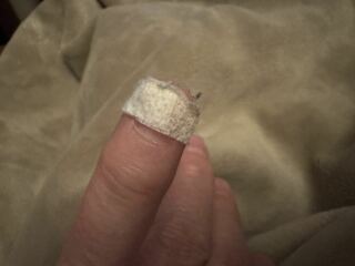 Ripped fingernail hell
