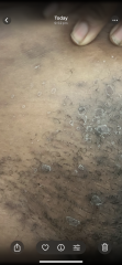 What could this be on my skin on my private parts ?!