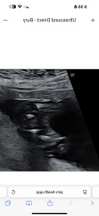 Boy or girl?