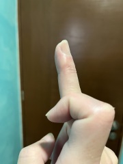 Boiling Water Blister And Medical Advice?