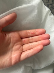 Help! What are these lumps??