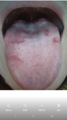 Possible B12 and Iron issues - GP not interested at all, what should I do?