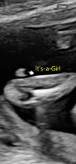 Girl or boy?