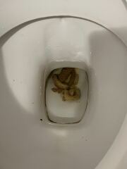 Constant weird pale poos