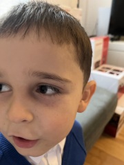 Son has a small rash that keeps coming up on face
