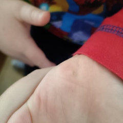 What is this?! Should I be worried?